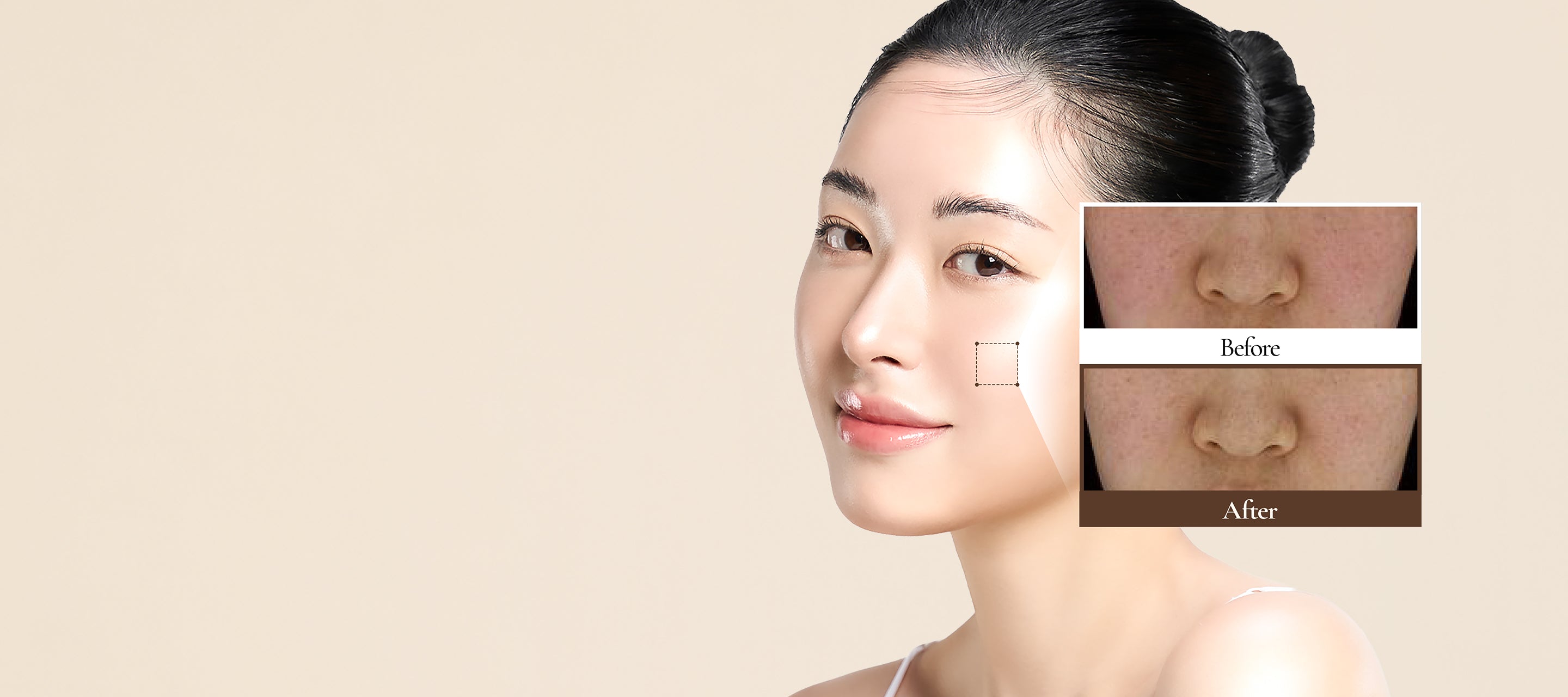 Real Before & After skin transformation in just two weeks, showing visibly reduced dullness and an improved tone, texture, and glow